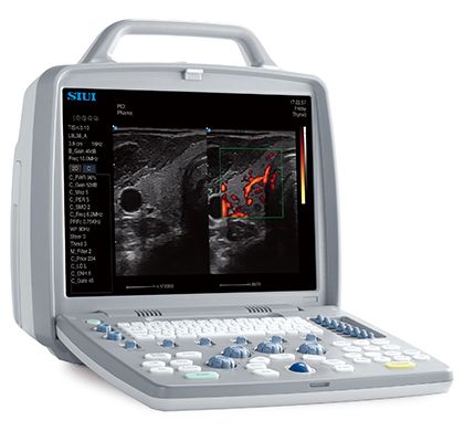 УЗИ аппарат Siui CTS-8800plus — изображение 7