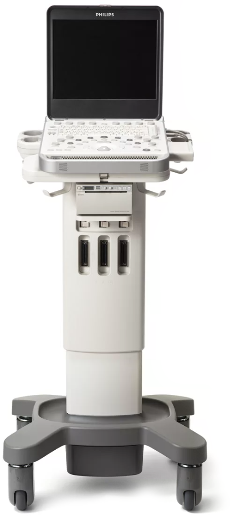 УЗИ аппарат Philips CX50 — изображение 2