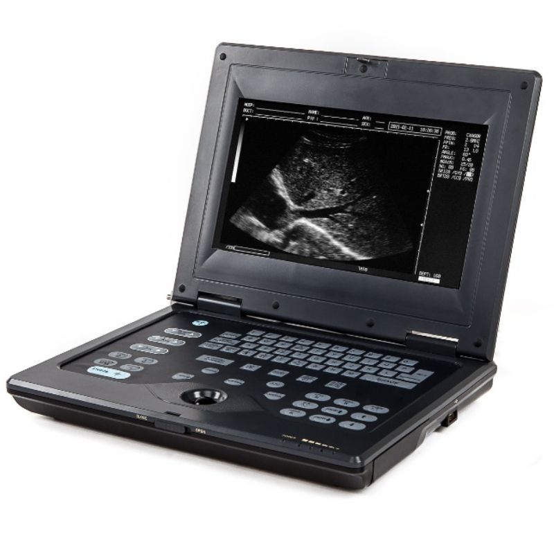 УЗИ аппарат Acuvista RS880c