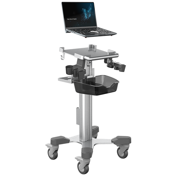УЗИ аппарат Chison SonoTouch 50 (SonoAir) — изображение 3