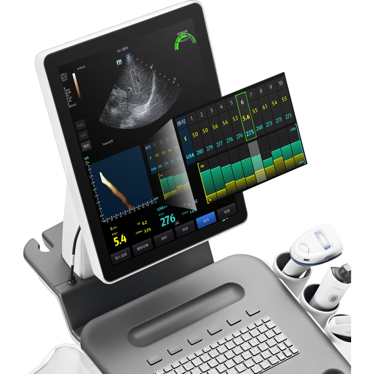 УЗИ аппарат Mindray Hepatus 6 — изображение 3