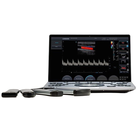 УЗИ аппарат Chison SonoTouch 50 (SonoAir) — изображение 2