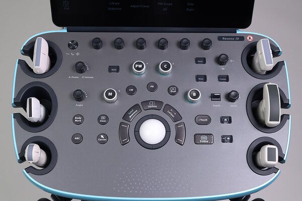 УЗИ аппарат Mindray Resona i9 Exp — изображение 3