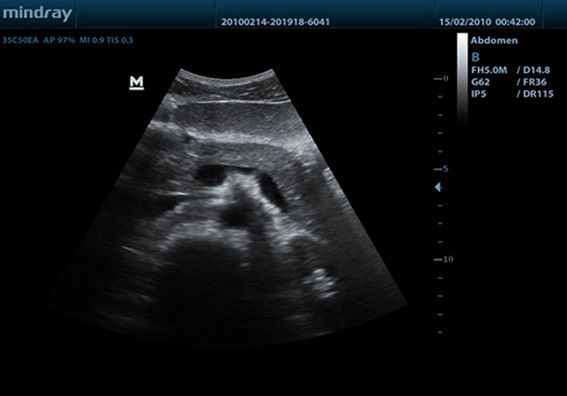 УЗИ аппарат Mindray DP-50 — изображение 9