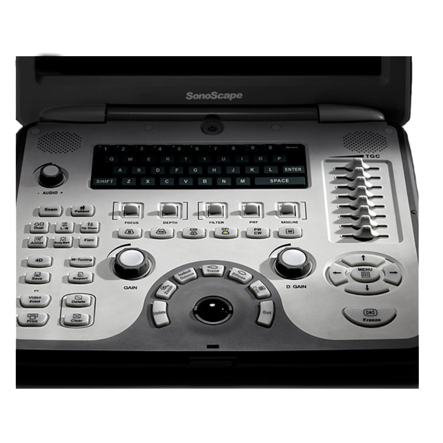 УЗИ аппарат Sonoscape S6V — изображение 3