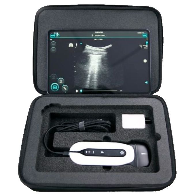 УЗИ аппарат Chison SonoTouch 30 (SonoEye) — изображение 2