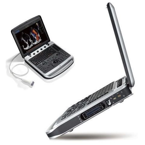 УЗИ аппарат Chison SonoTouch 80 Exp — изображение 3