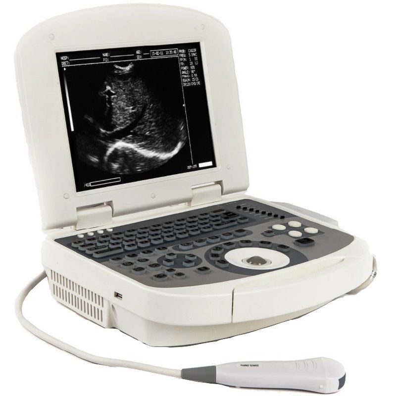 УЗИ аппарат Acuvista VT98c