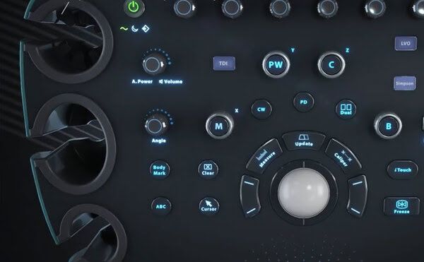 УЗИ аппарат Mindray Resona i9 — изображение 3