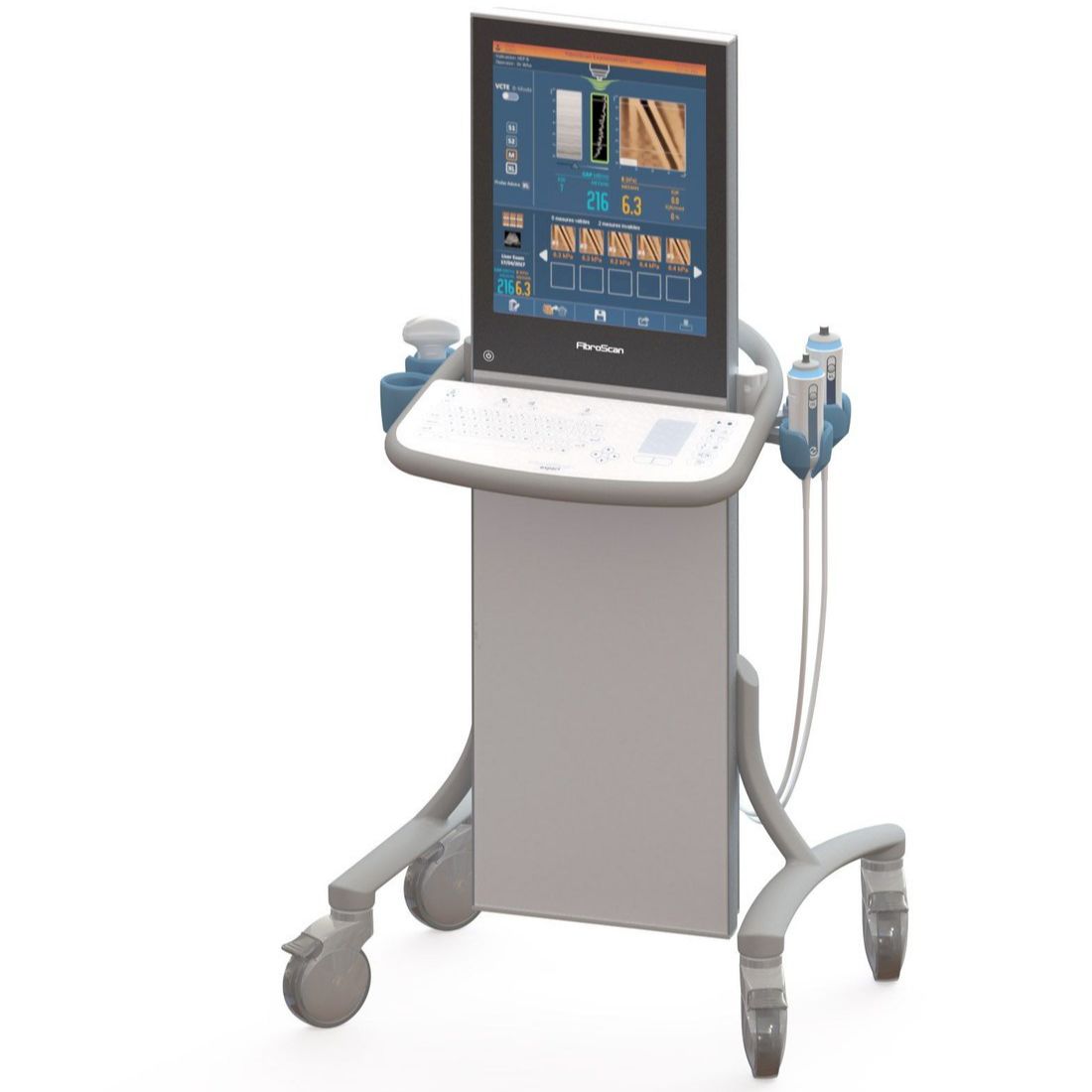 УЗИ аппарат Echosens FibroScan 630 exp — изображение 2